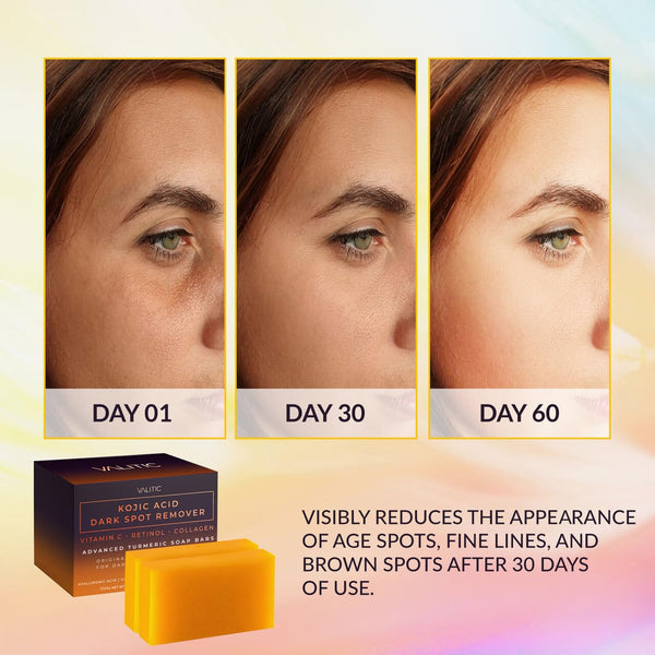 Kojic Acid Turmeric Dark Spot Remover Soap Bars
