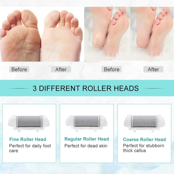 SilkFeet™ - Rechargeable Electric Foot File for Callus Removal